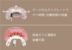 設計どおりの外科・補綴の実現